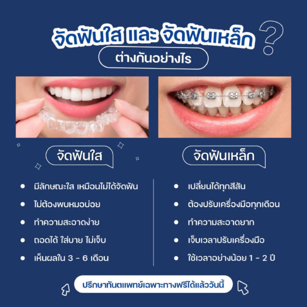 โปรโมชั่นจัดฟัน DrCC