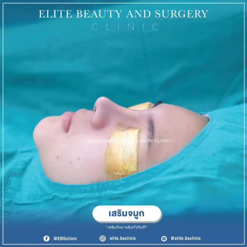 ห้องคนไข้ ELITE Clinic เชียงราย