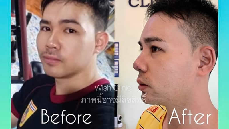 WISH Clinic