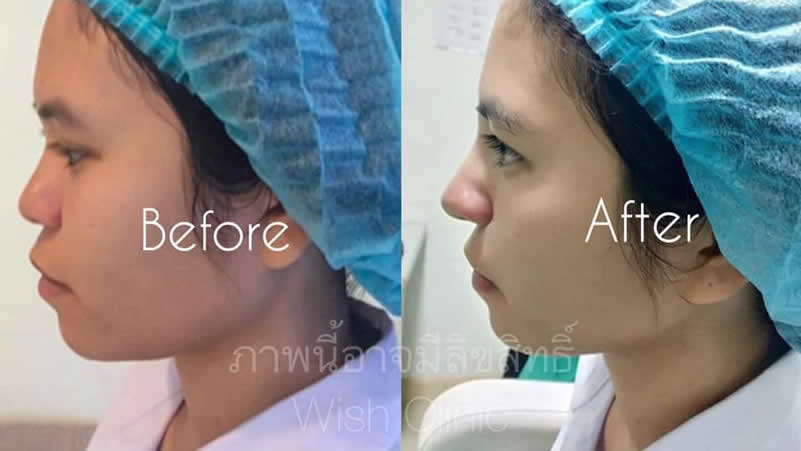 WISH Clinic