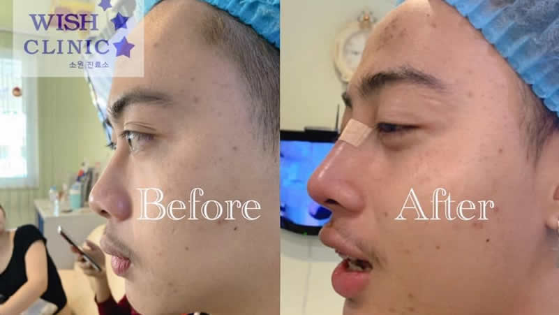 WISH Clinic